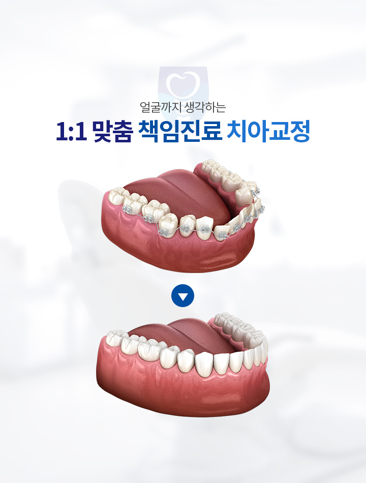 1:1 맞춤 책임진료 치아교정