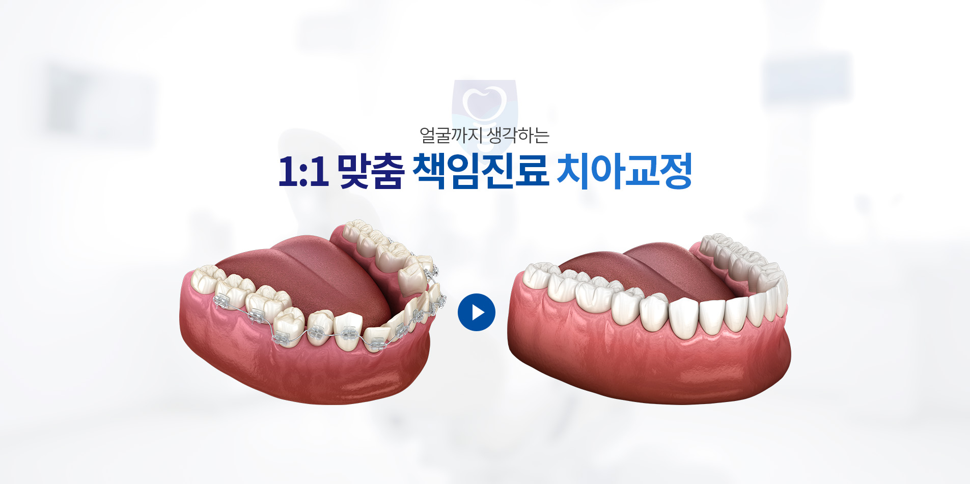 1:1 맞춤 책임진료 치아교정