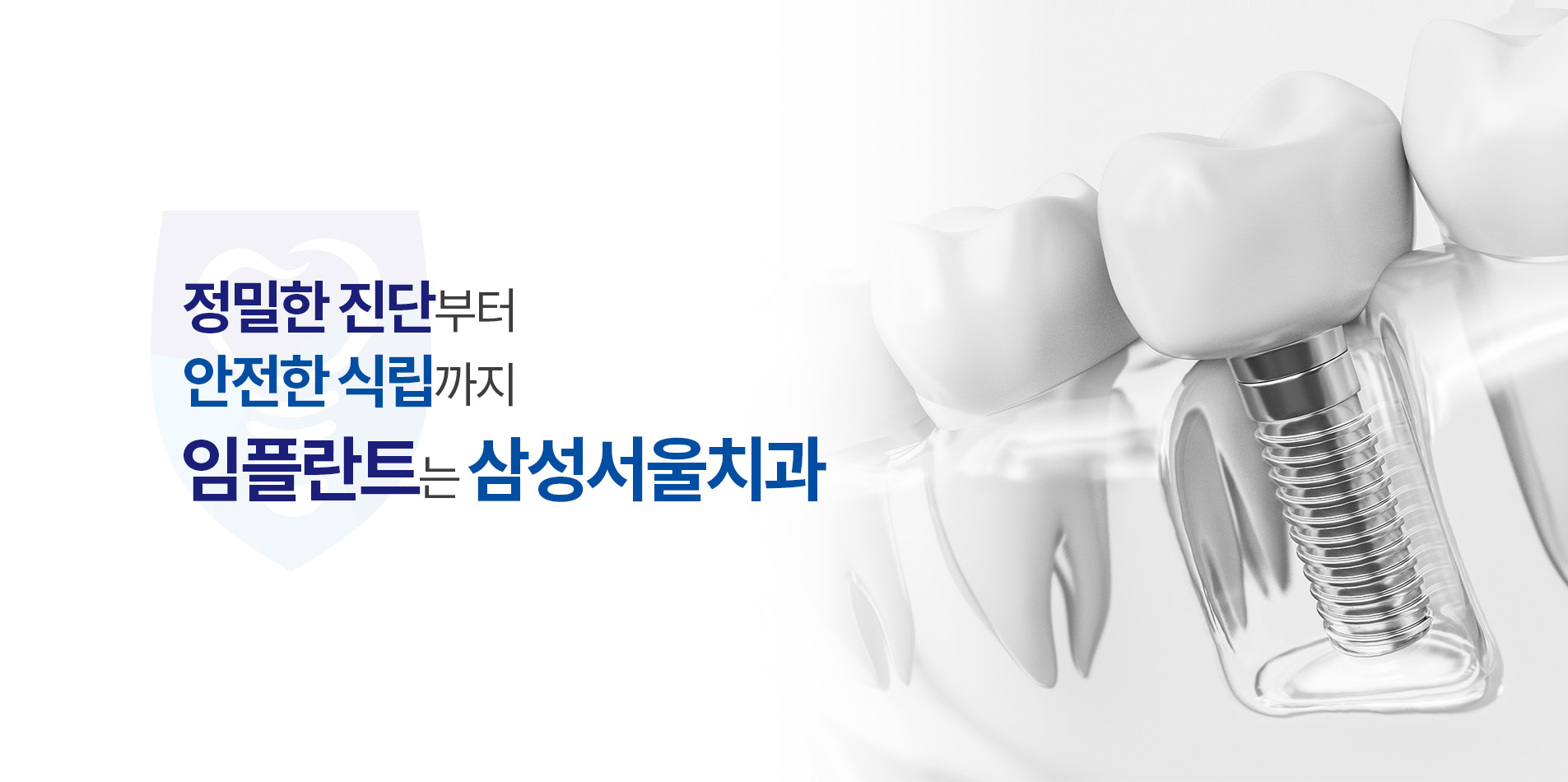 사랑니 발치 고민하지 않으셔도 됩니다.