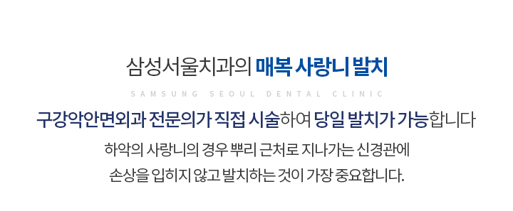 매복 사랑니 발치
