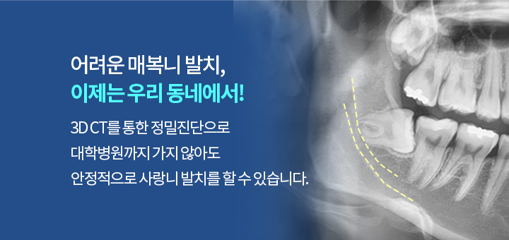 어려운 매복니 발치, 이제는 우리 동네에서!