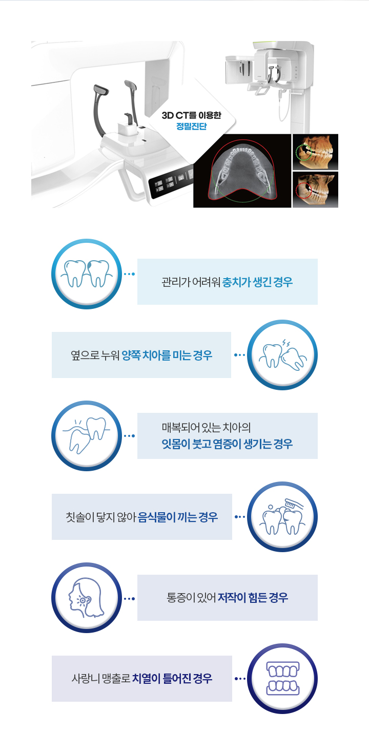 3D CT를 이용한 정밀진단