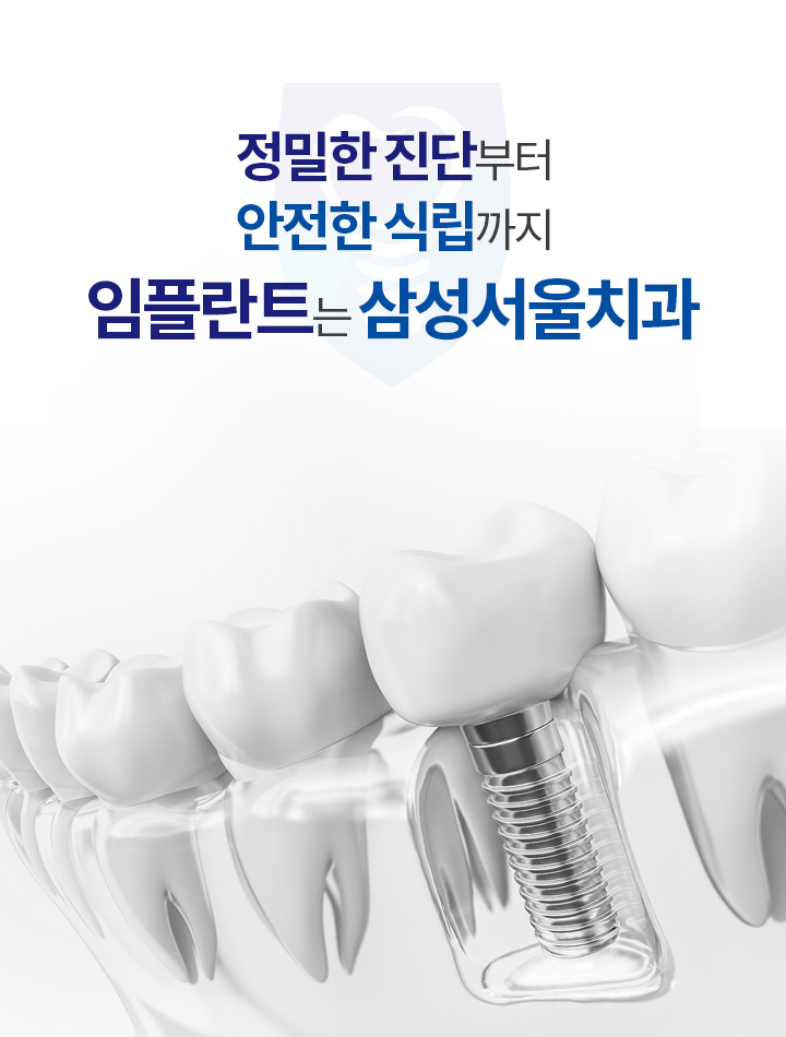임플란트는 삼성서울치과