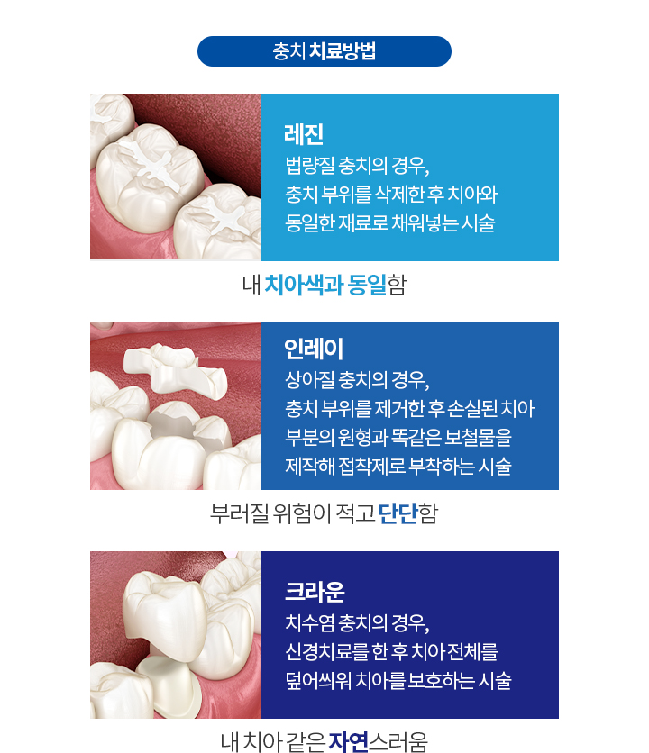충치 치료방법