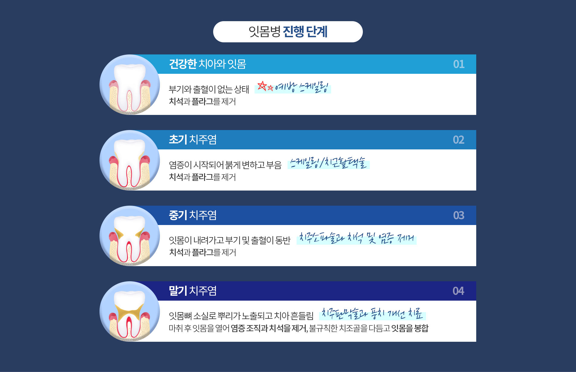 잇몸병 진행 단계