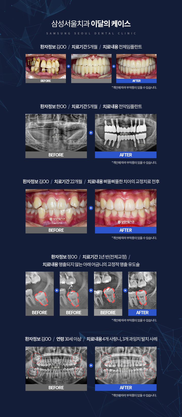 이달의 케이스