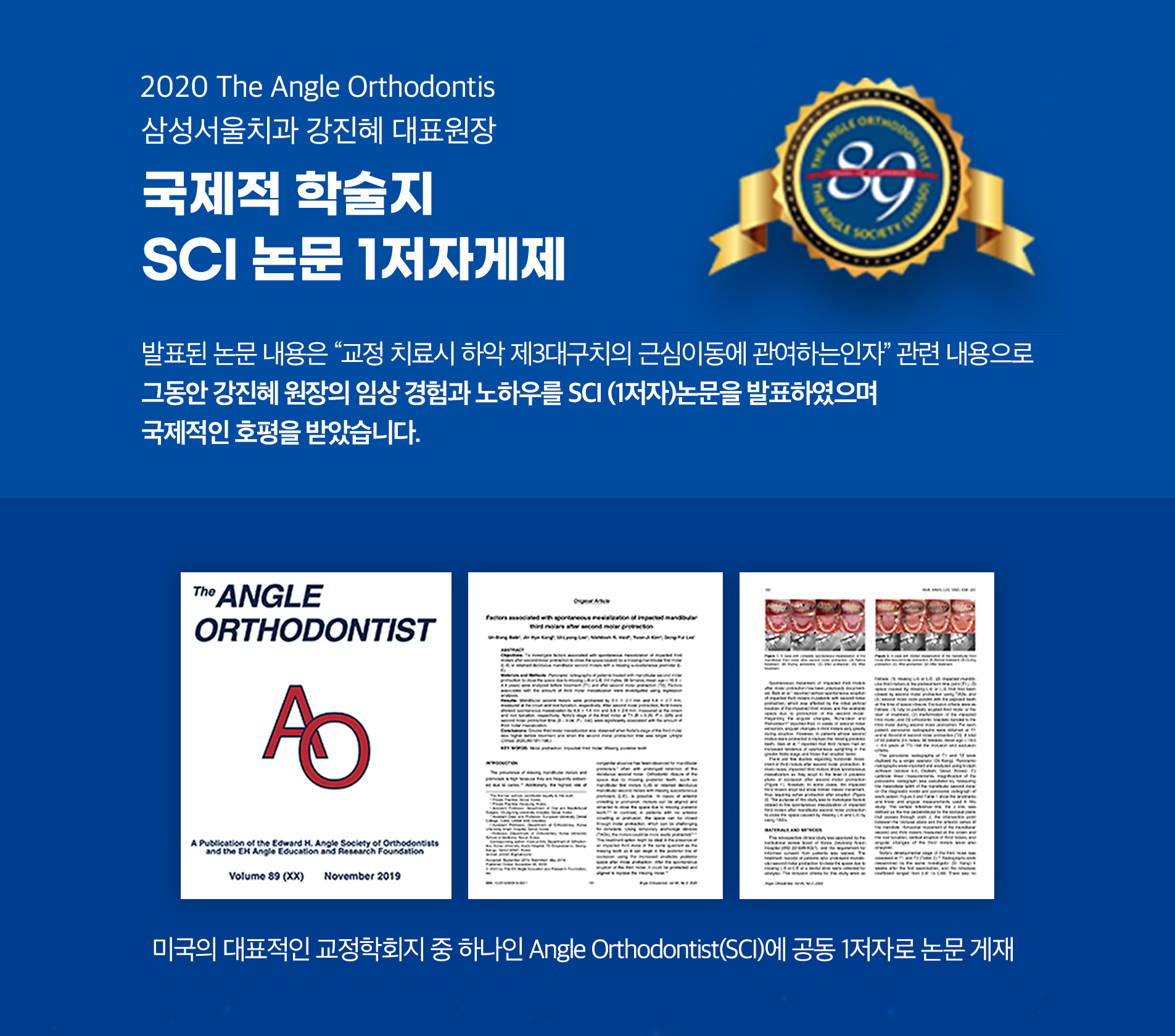 국제적 학술지 SCI 논문 1저자 게제